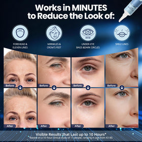 Nabevin KKP Rapid Reduction Eye Serum packaging highlights skin-type compatibility