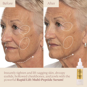 Eye-area closeup highlighting the BeautifEYE Complex for refreshed look