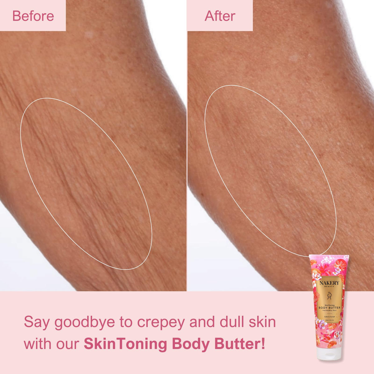 Nakery neck, arms, and legs firming lotion improves elasticity.