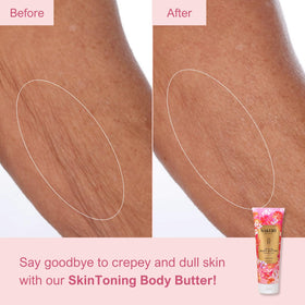 Nakery neck, arms, and legs firming lotion improves elasticity.