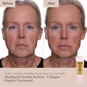 Nakery Retinol Cream label details showing collagen and hyaluronic acid