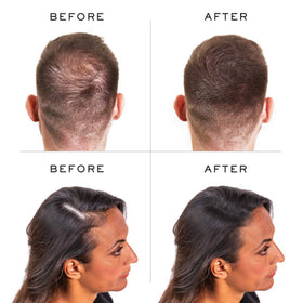 Nanogen Keratin Hair Fibers are paraben-free and gentle on sensitive scalps.
