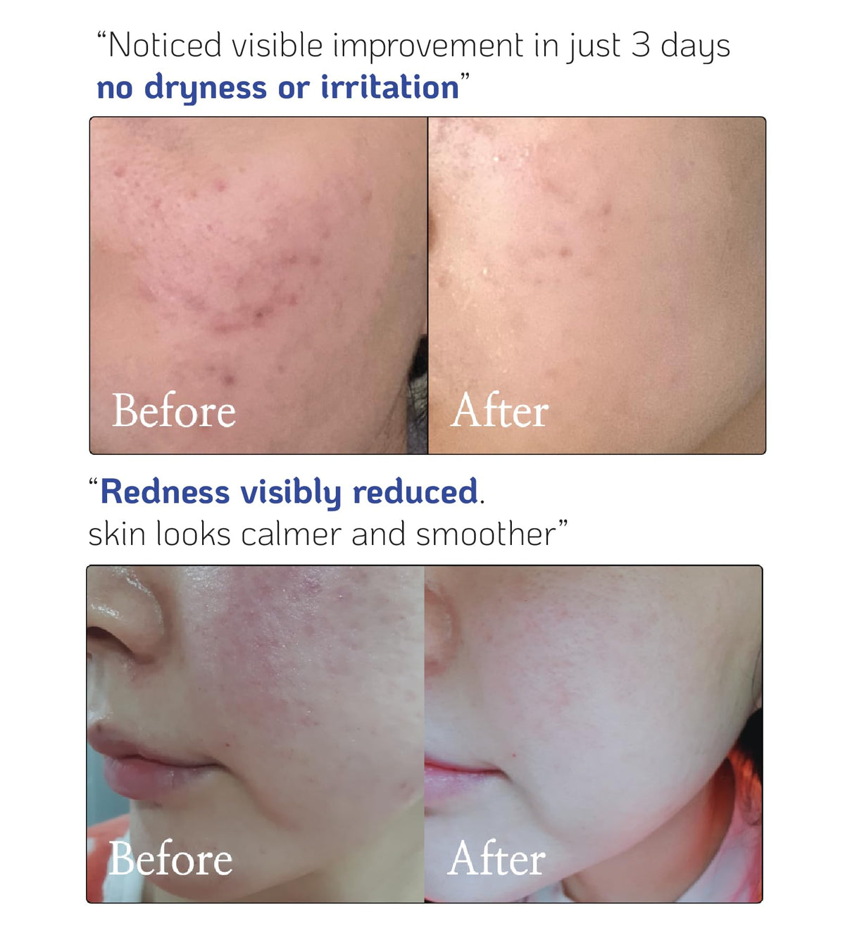Nano Recipe ceramide concentrate on skin demonstrates hydrating application.