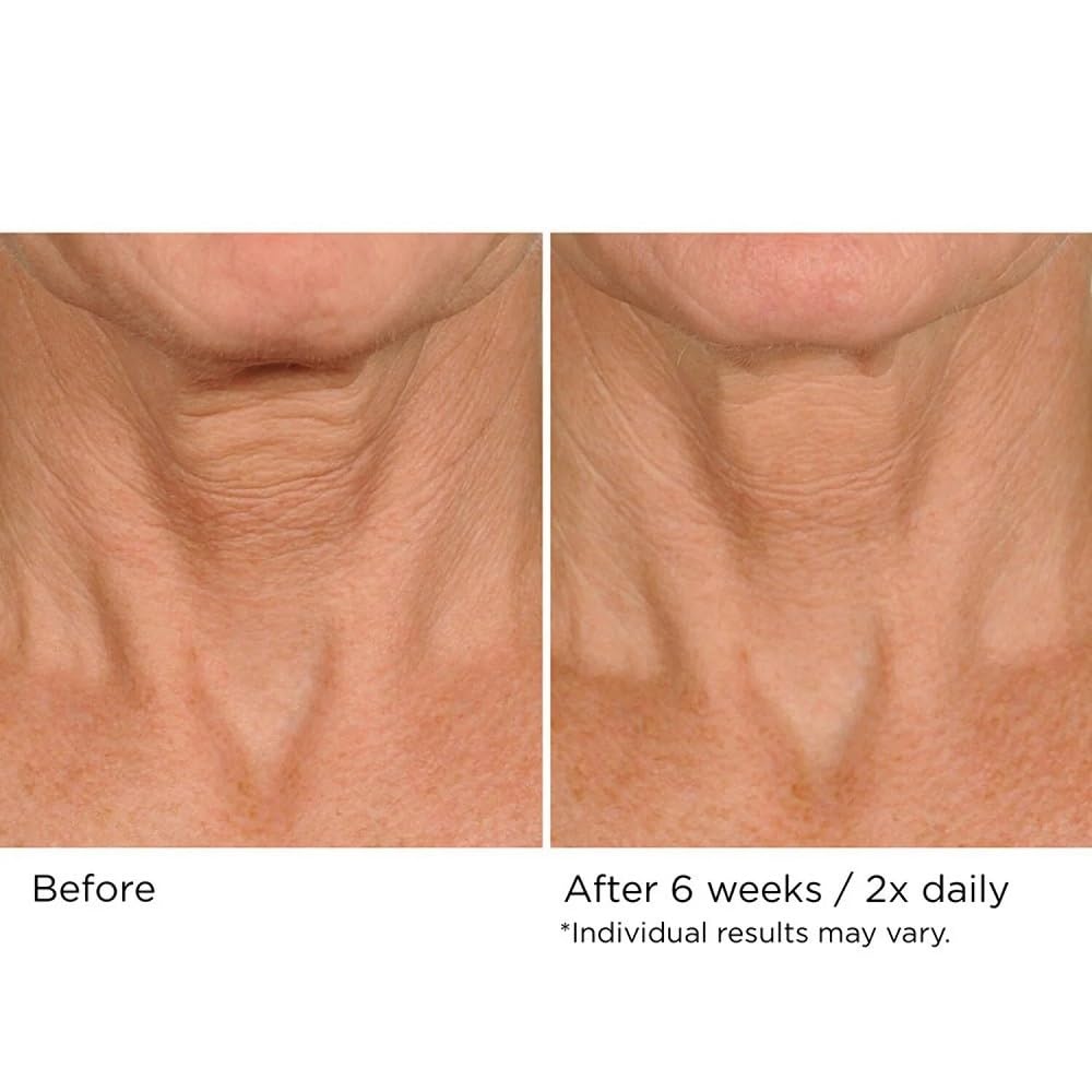 NassifMD Deco-Lift decollete texture closeup demonstrates refined skin texture