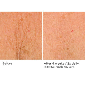NassifMD Deco-Lift gel application demonstrates quick absorption without sticky residue