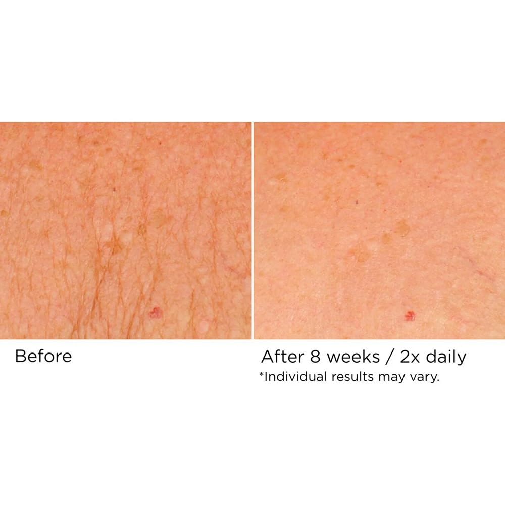 NassifMD Deco-Lift peptide ingredient label emphasizes antioxidant protection