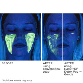 NassifMD Gentle Detox Pad with aloe scent offers refreshing cleanse.