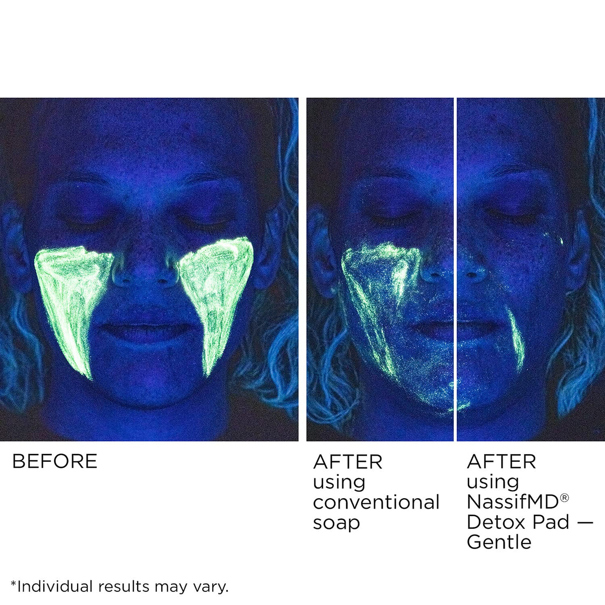 NassifMD pad with hyaluronic acid supports moisture for smoother skin.