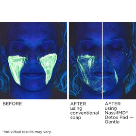 NassifMD pad with hyaluronic acid supports moisture for smoother skin.