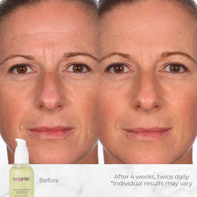 NassifMD Hydro-Screen texture close-up highlights silky, fast-absorbing formula