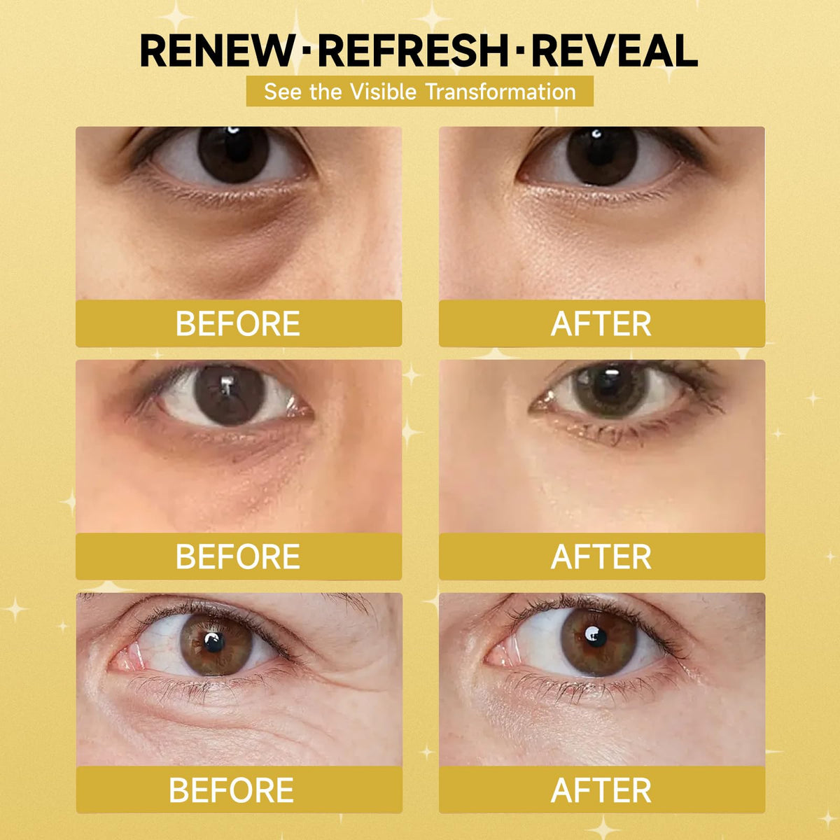 Natener travel-friendly eye care patches for on-the-go refreshment
