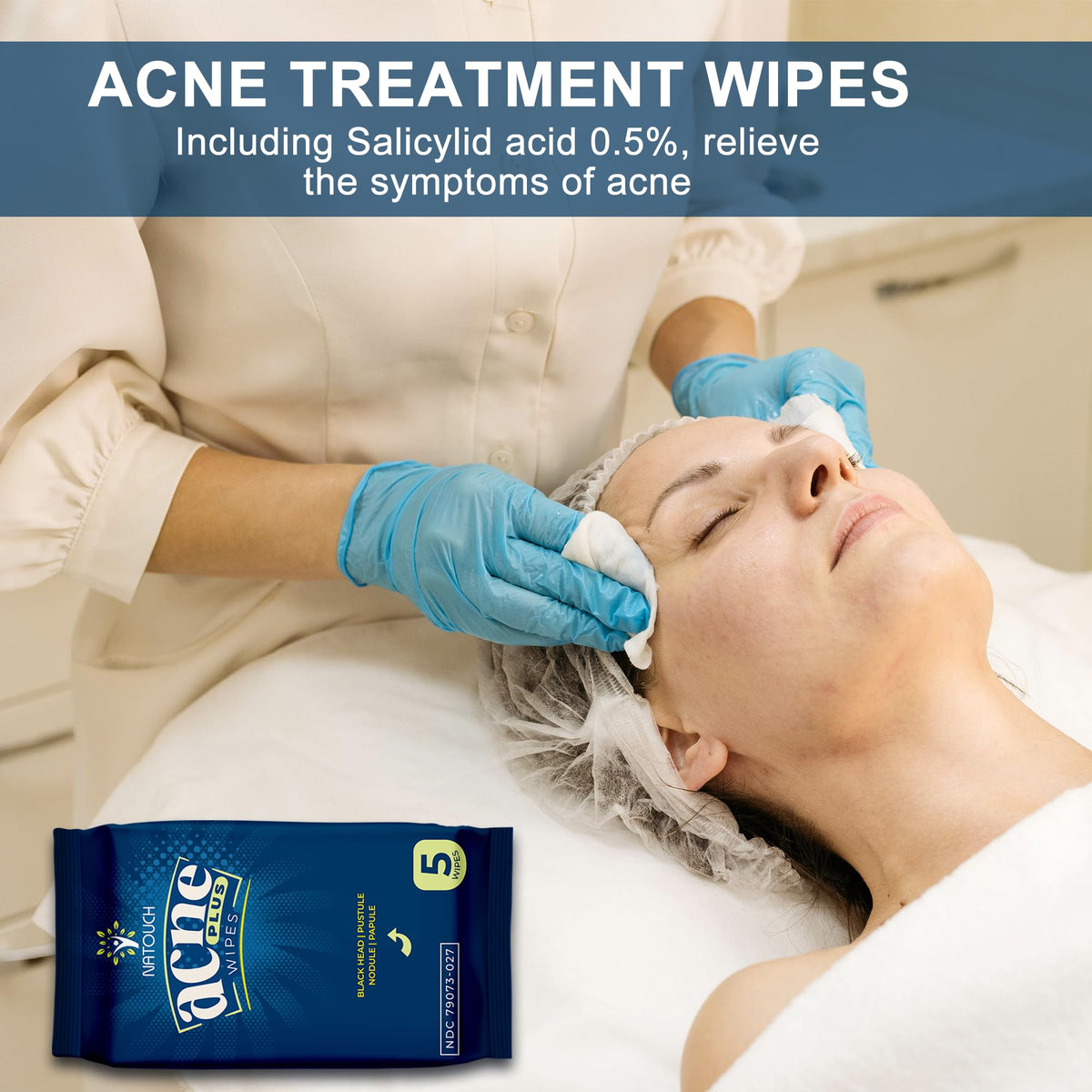Natouch acne wipes applied to back cleansing and shine reduction.