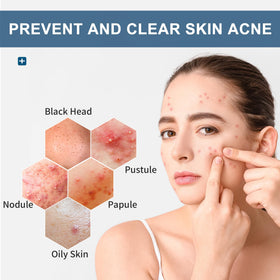 Natouch acne wipes for face during morning routine delivering clean skin.