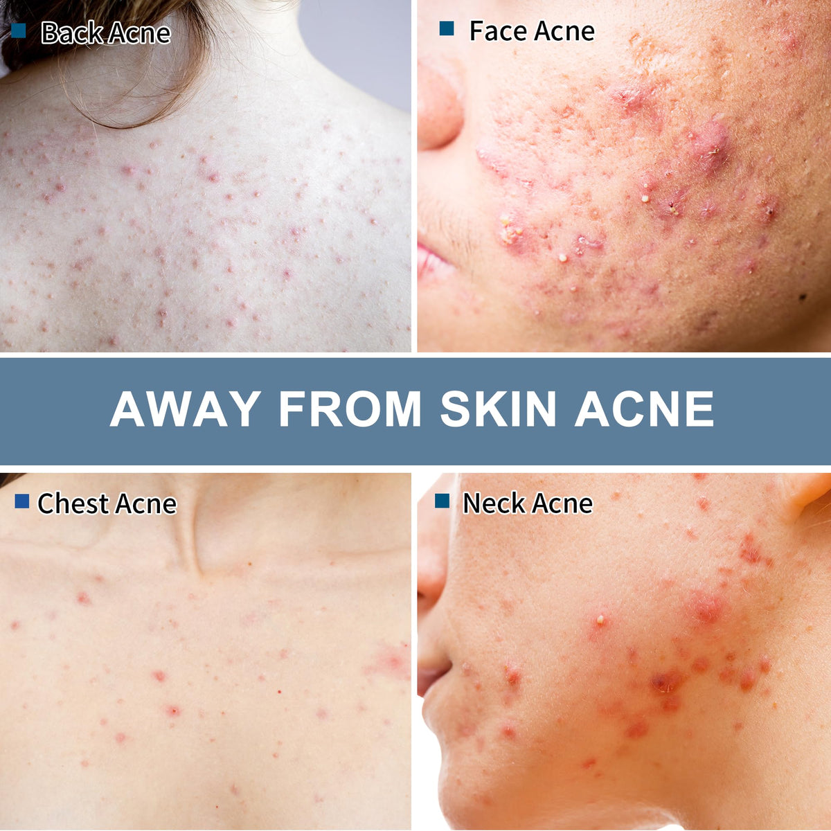 Natouch acne wipes ingredients highlight natural oils and plant extracts for skin care.