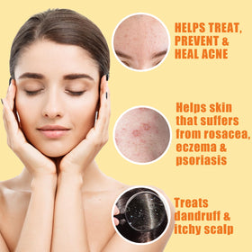 Natrulo sulfur bar blemish cleanse for oil control and shine reduction