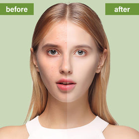 Natura Derm Tea Tree Oil Facial Soap ingredients reveal natural antifungal hints for balance.