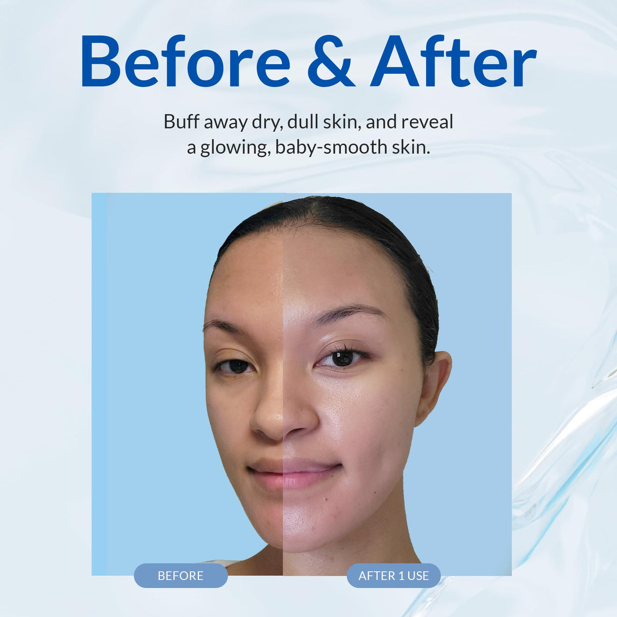 NATURAL AQUA GEL CURE skin after use reveals softer, more even texture.