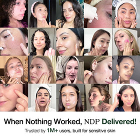 NDP mask on face demonstrates soothing, depuffing application for refreshed skin