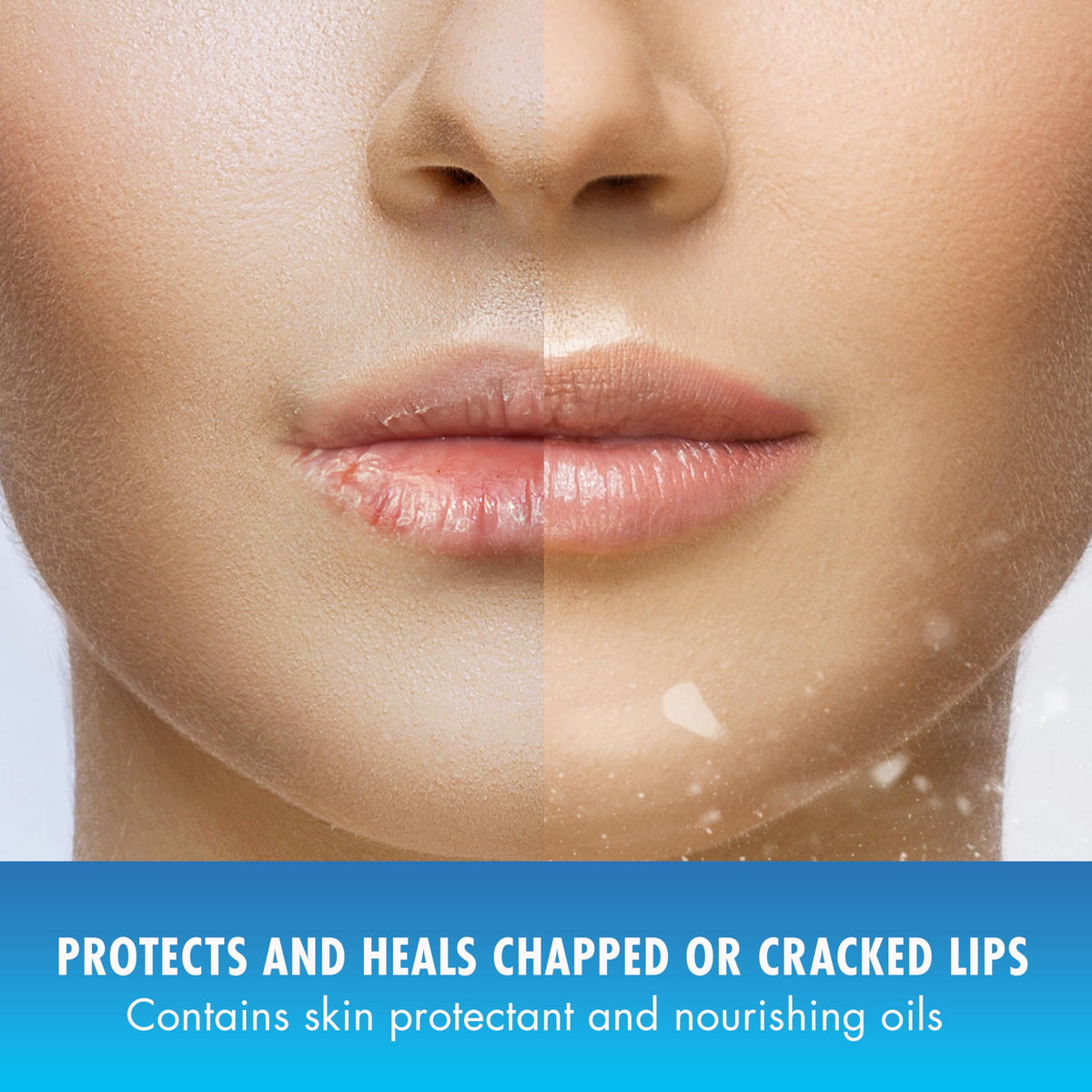 Natural Ice Medicated Lip Balm offers cooling relief for dry lips.