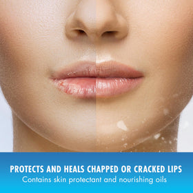 Natural Ice Medicated Lip Balm offers cooling relief for dry lips.