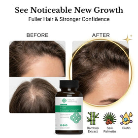 Natural Wellbeing Hair Essentials capsules pour shows easy dosing for ongoing DHT-blocking care