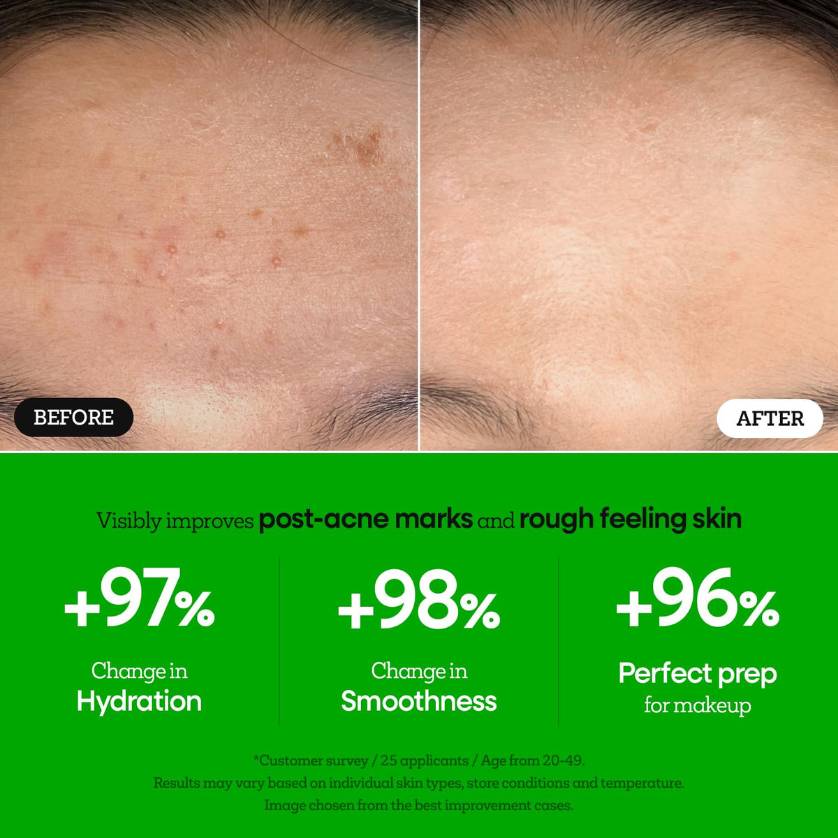 Nature Republic The First Peptide Boosting Serum application on skin suggests priming benefits.