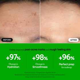 Nature Republic The First Peptide Boosting Serum application on skin suggests priming benefits.