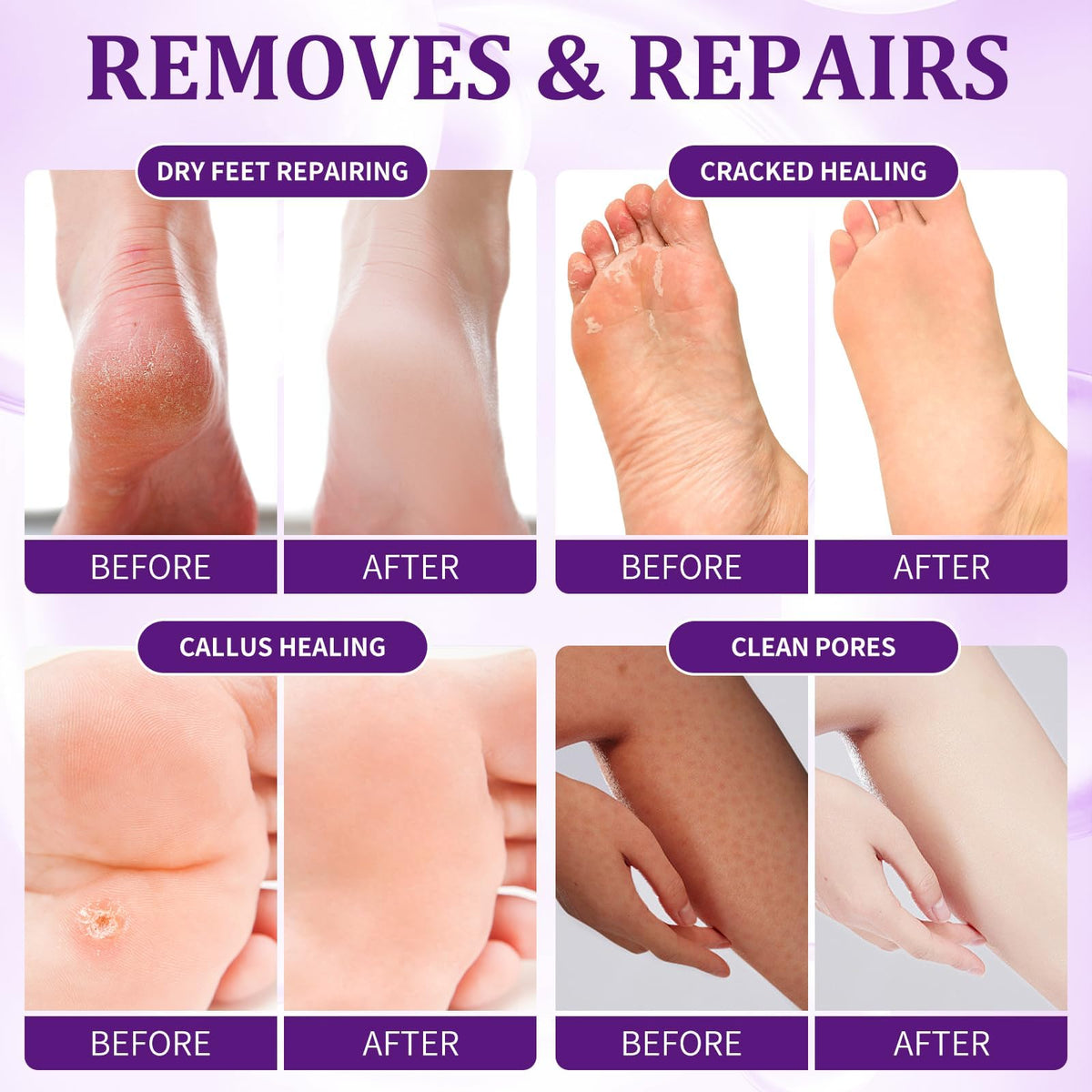 NBC BeautiLab pedicure kit foot soak massage mask for nourishing pampering.