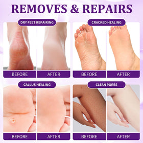 NBC BeautiLab pedicure kit foot soak massage mask for nourishing pampering.