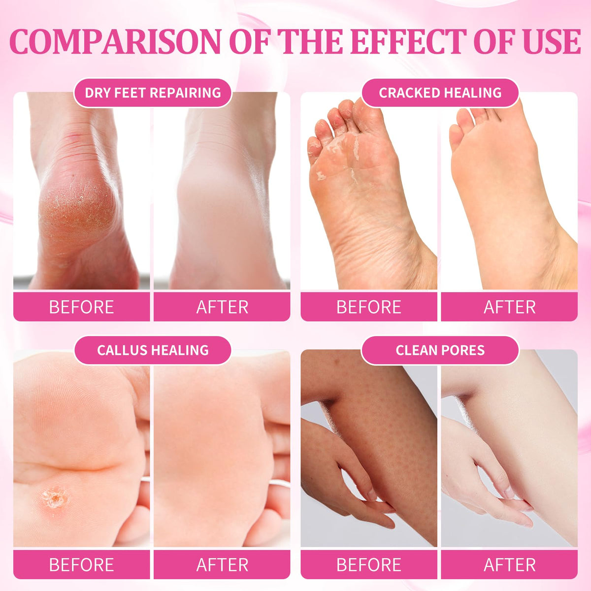 nbc BeautiLab Massage Mask helps soften rough spots for comfortable feet