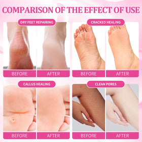 nbc BeautiLab Massage Mask helps soften rough spots for comfortable feet