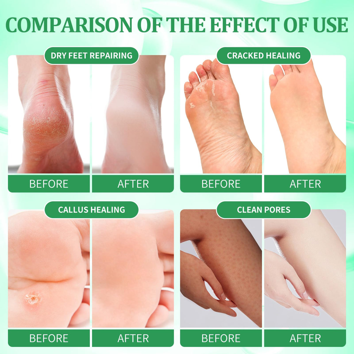 NBC BeautiLab pedicure kit massage mask relaxes tired feet