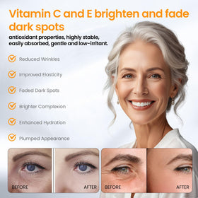 NEIOM Vitamin C Serum bottle cap closeup shows premium formula and precision dispensing.
