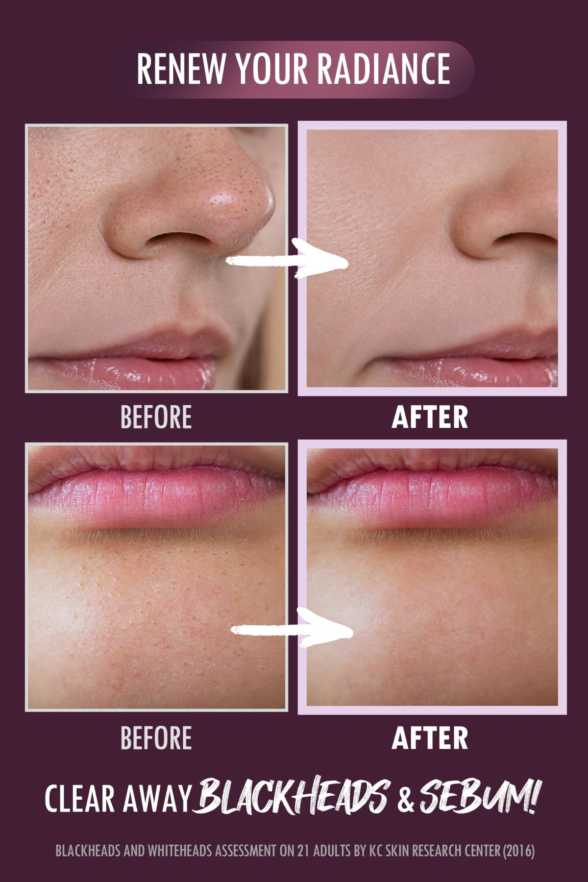 NEOGEN Code9 Pore Tight Peeling Mousse in use for gentle exfoliation routine.