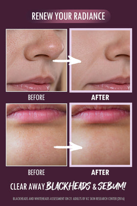 NEOGEN Code9 Pore Tight Peeling Mousse in use for gentle exfoliation routine.