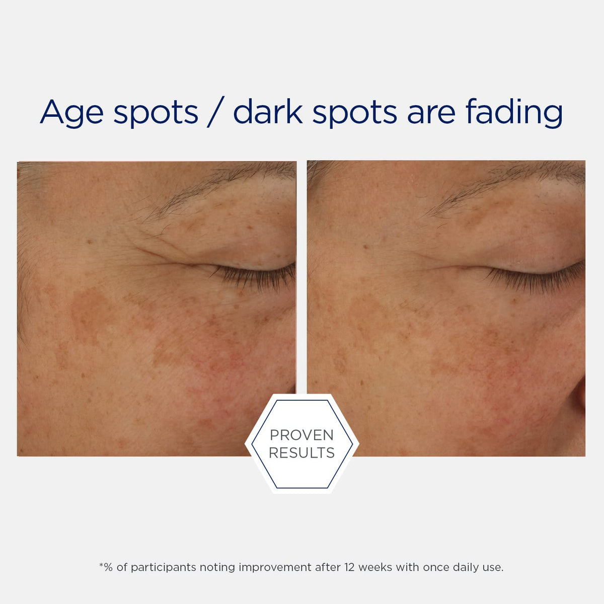 NEOSTRATA Potent Retinol Complex Night Serum fragrance-free label communicates gentle nightly care.