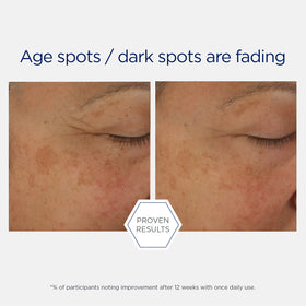 NEOSTRATA Potent Retinol Complex Night Serum fragrance-free label communicates gentle nightly care.