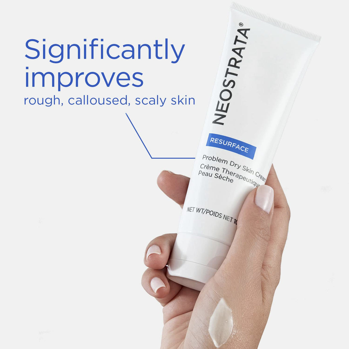 NEOSTRATA cream visible on elbows and knees for smoother skin