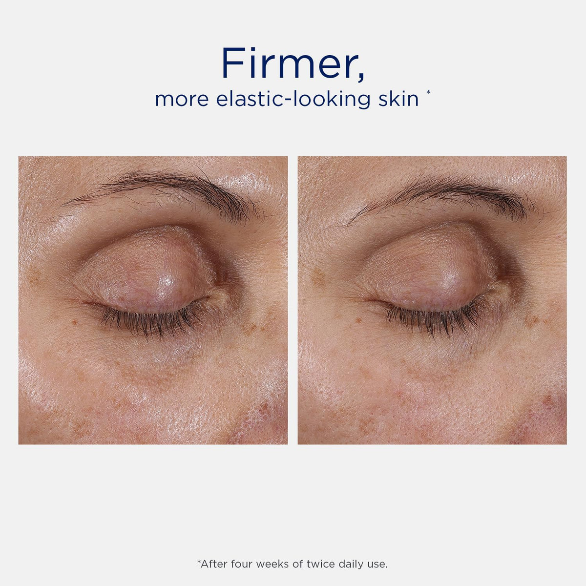 Dab of NEOSTRATA Eye Therapy applied under the eye for a refreshed look