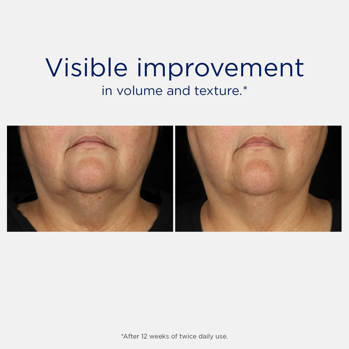 NEOSTRATA Tri-Therapy Lifting Serum skin glow after application.