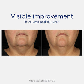 NEOSTRATA Tri-Therapy Lifting Serum skin glow after application.
