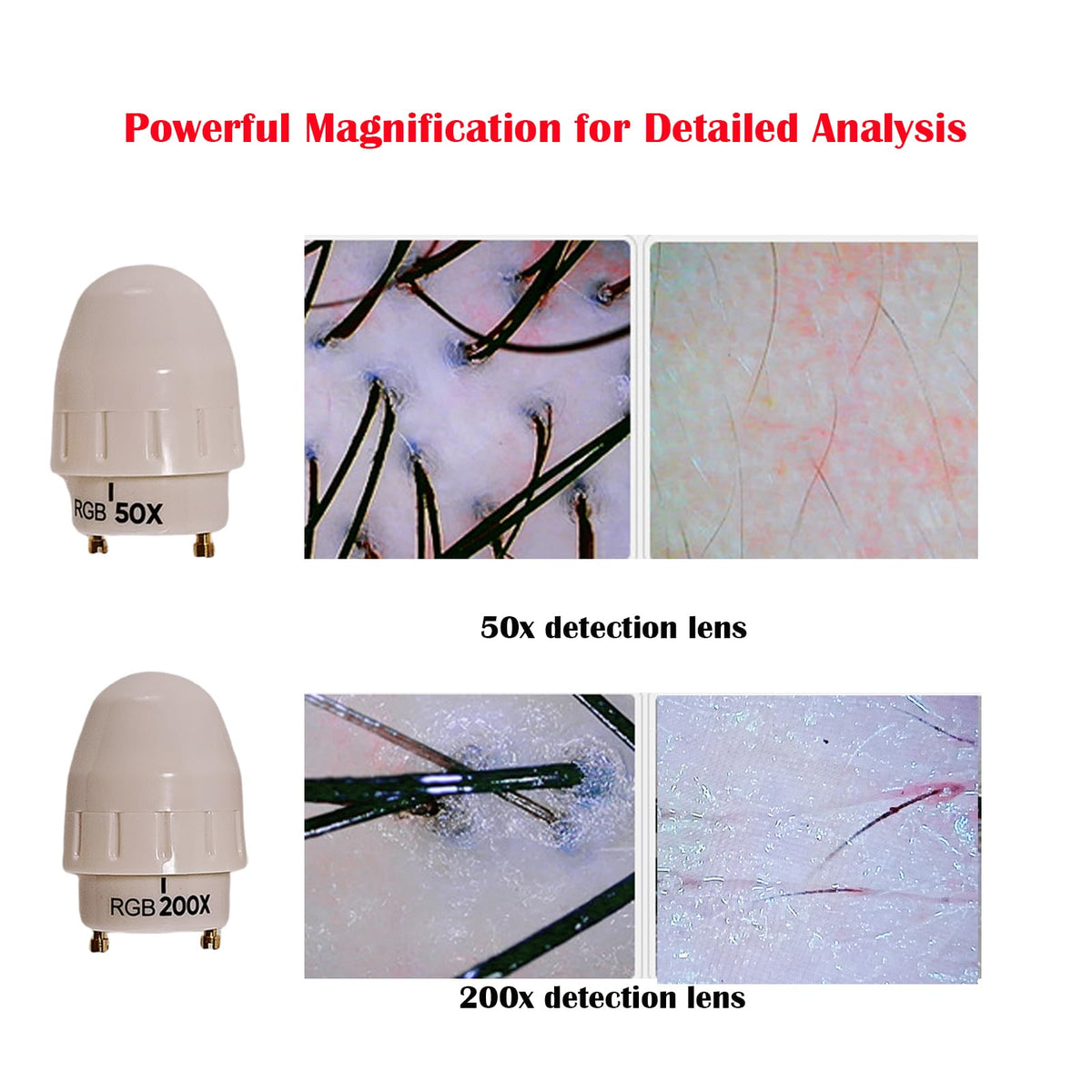 NETTITO high-definition imaging highlights detailed hair follicle views for accurate assessments.