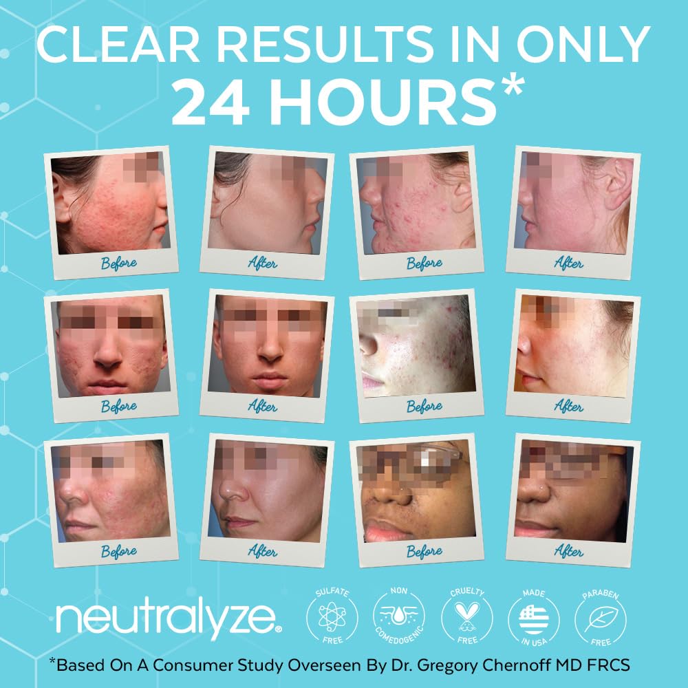 Neutralyze 90-day kit on display for consistent care.