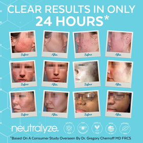 Neutralyze 90-day kit on display for consistent care.