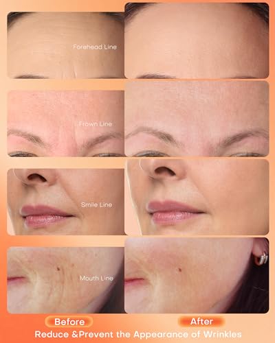 NEWKEY face mask ergonomic design for comfortable long sessions.