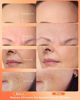 NEWKEY face mask ergonomic design for comfortable long sessions.