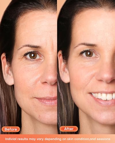 NEWKEY LED mask seven colors panel demonstrates full-face coverage.