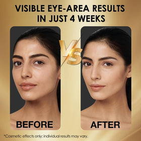 NIAWIT Eye Serum provides lightweight hydration without greasiness.