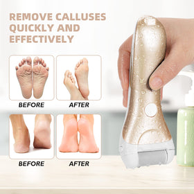 NiceBirdie rechargeable power indicator and long-lasting battery for all-in-one pedicure.