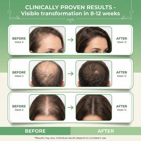Nigwedete biotin caffeine growth blend close-up highlights fortified scalp support